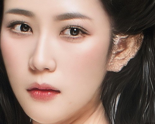 一、肋骨鼻的手术过程,肋骨鼻手术,全无创自然鼻型手术指南